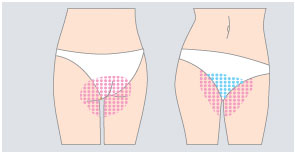 VラインとIラインの図